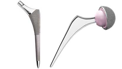 hip replacement